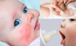 Süt Ürünlerine Alerji Nedir?