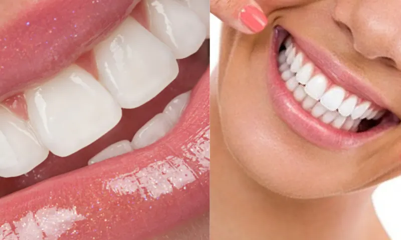 dişlaminası-2-li-1